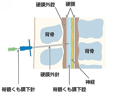 図B