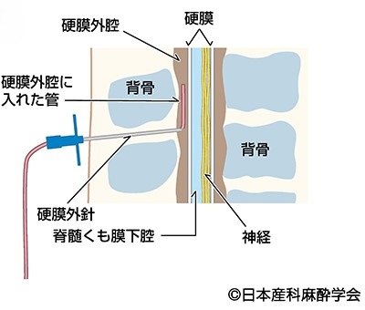 図C